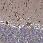 RALGAPB Antibody in Immunohistochemistry (Paraffin) (IHC (P))