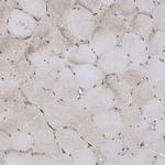 RALGAPB Antibody in Immunohistochemistry (Paraffin) (IHC (P))