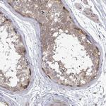 RALGAPB Antibody in Immunohistochemistry (Paraffin) (IHC (P))
