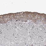RALGAPB Antibody in Immunohistochemistry (Paraffin) (IHC (P))