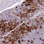 Annexin 2 Receptor Antibody in Immunohistochemistry (Paraffin) (IHC (P))