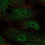 Annexin 2 Receptor Polyclonal Antibody