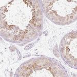 PDXDC1 Antibody in Immunohistochemistry (IHC)