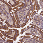 ZNF513 Antibody in Immunohistochemistry (Paraffin) (IHC (P))