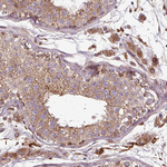 ZNF513 Polyclonal Antibody