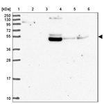 ZNF513 Antibody in Western Blot (WB)