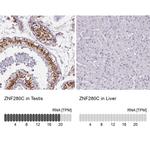 ZNF280C Antibody in Immunohistochemistry (IHC)