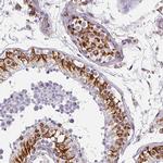 ZNF280C Antibody in Immunohistochemistry (IHC)