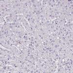 ZNF280C Antibody in Immunohistochemistry (IHC)