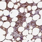 TMEFF1 Antibody in Immunohistochemistry (Paraffin) (IHC (P))