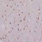 TCEAL7 Polyclonal Antibody