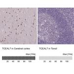 TCEAL7 Antibody in Immunohistochemistry (IHC)