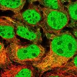 MAP7D2 Polyclonal Antibody