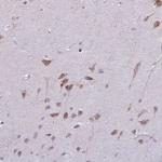 MAP7D2 Antibody in Immunohistochemistry (Paraffin) (IHC (P))