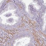 MAP7D2 Antibody in Immunohistochemistry (Paraffin) (IHC (P))