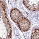 MAP7D2 Antibody in Immunohistochemistry (Paraffin) (IHC (P))