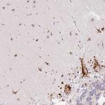 CLEC3A Antibody in Immunohistochemistry (Paraffin) (IHC (P))