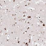 CLEC3A Polyclonal Antibody