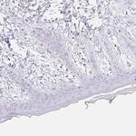 CLEC3A Antibody in Immunohistochemistry (Paraffin) (IHC (P))