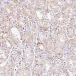 CLEC3A Antibody in Immunohistochemistry (Paraffin) (IHC (P))