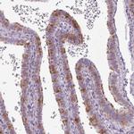 GPT2 Polyclonal Antibody
