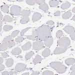 ADAR Antibody in Immunohistochemistry (Paraffin) (IHC (P))