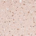 NELL1 Antibody in Immunohistochemistry (Paraffin) (IHC (P))