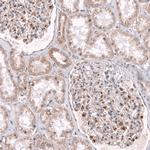 NELL1 Polyclonal Antibody