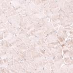 NELL1 Antibody in Immunohistochemistry (Paraffin) (IHC (P))