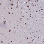 TIMM21 Antibody in Immunohistochemistry (Paraffin) (IHC (P))