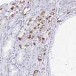 KCNE2 Polyclonal Antibody