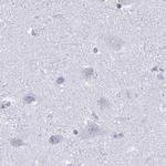 KCNE2 Antibody in Immunohistochemistry (IHC)
