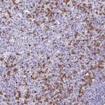 CEP120 Polyclonal Antibody