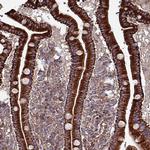 TMEM16K Antibody in Immunohistochemistry (Paraffin) (IHC (P))