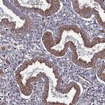 TMEM16K Antibody in Immunohistochemistry (Paraffin) (IHC (P))