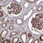TMEM16K Antibody in Immunohistochemistry (Paraffin) (IHC (P))