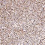 RIC1 Antibody in Immunohistochemistry (Paraffin) (IHC (P))