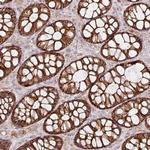 RIC1 Antibody in Immunohistochemistry (Paraffin) (IHC (P))