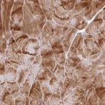 RIC1 Antibody in Immunohistochemistry (Paraffin) (IHC (P))