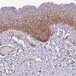 RIC1 Polyclonal Antibody