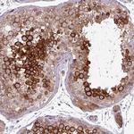 CNTRL Polyclonal Antibody