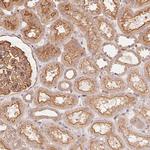 FRAS1 Polyclonal Antibody