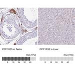 PPP1R35 Polyclonal Antibody