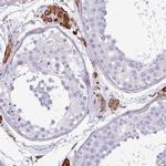 PPP1R35 Antibody in Immunohistochemistry (IHC)