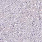 PPP1R35 Antibody in Immunohistochemistry (IHC)