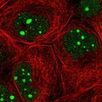 GTF3C1 Polyclonal Antibody