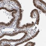 GTF3C1 Antibody in Immunohistochemistry (Paraffin) (IHC (P))
