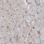 GTF3C1 Antibody in Immunohistochemistry (Paraffin) (IHC (P))