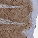 GTF3C1 Antibody in Immunohistochemistry (Paraffin) (IHC (P))