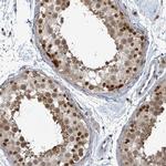 GTF3C1 Antibody in Immunohistochemistry (Paraffin) (IHC (P))